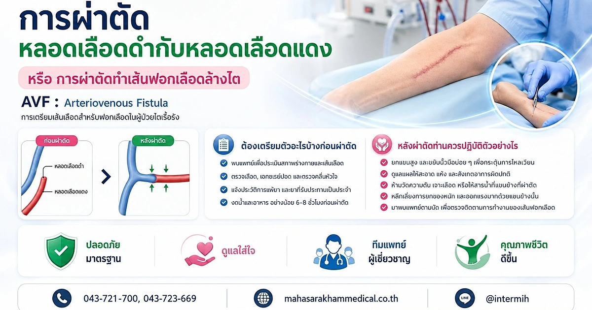 การผ่าตัดหลอดเลือดดำกับหลอดเลือดแดง (AVF)